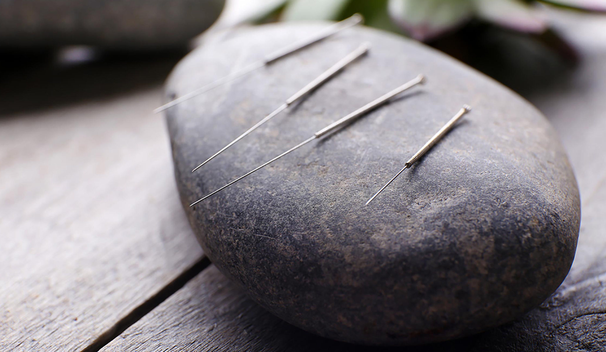 Acupuncture Pain From Needles at Tim Malcolm blog