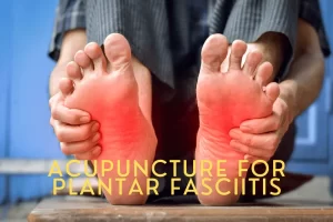 Acupuncture For Plantar Fasciitis